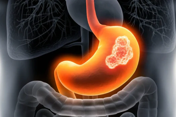 68b6f6370c561fee67e5cbdd